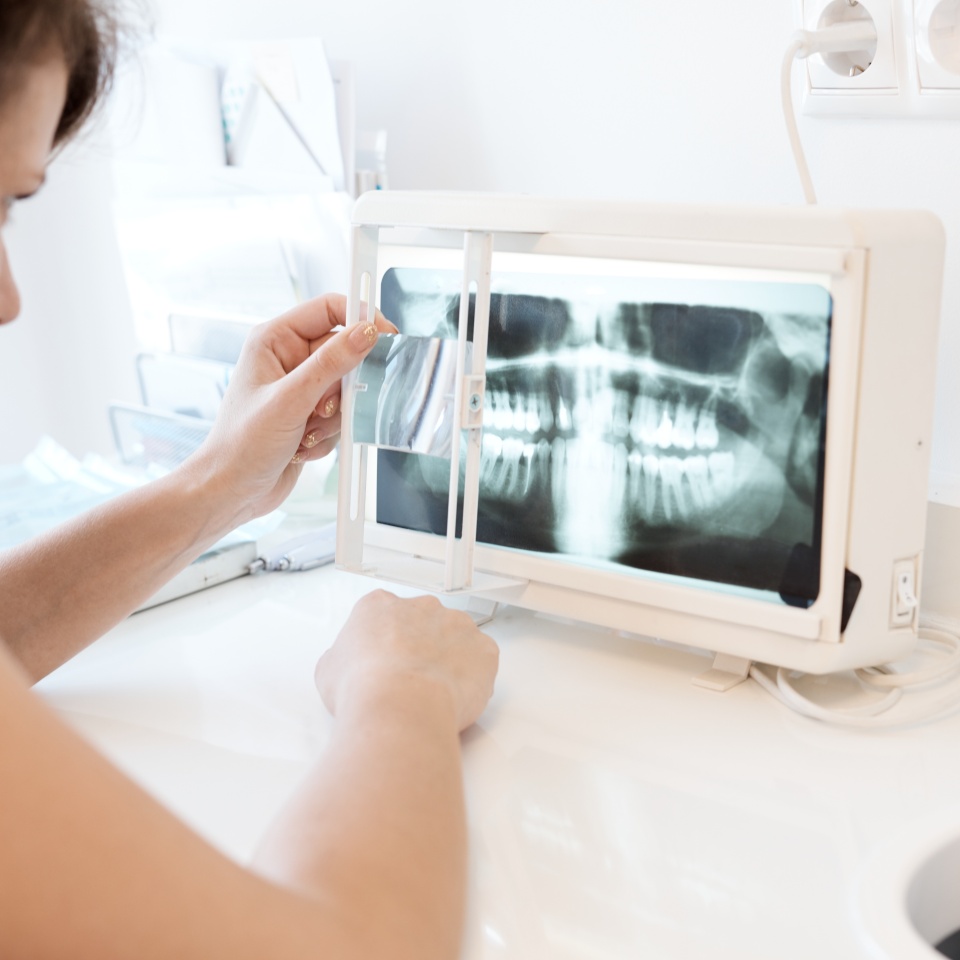 Female dental surgeon studying dental panoramic x-ray image.
